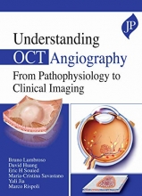 کتاب آندرستندینگ او سی تی آنژیوگرافی فرام پاتو فیزولوژی کلینیکال ایمیجینگ Understanding OCT Angiography From Pathophysiology to