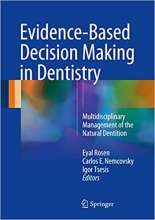 کتاب اویدنس بیسد دسیژن میکینگ این دنتیستری Evidence-Based Decision Making in Dentistry : Multidisciplinary Management of the Nat